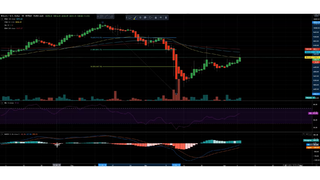 Why Bitcoin is a BUY right NOW!